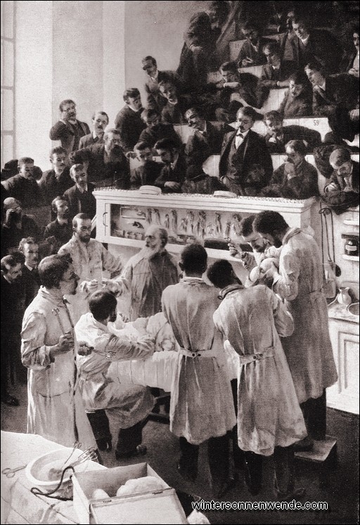 Theodor Billroth bei einer Operation im Allgemeinen Krankenhaus in Wien.