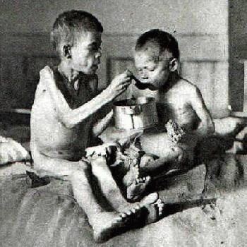 Post-World War I German Poverty: Under-Nourished German Children